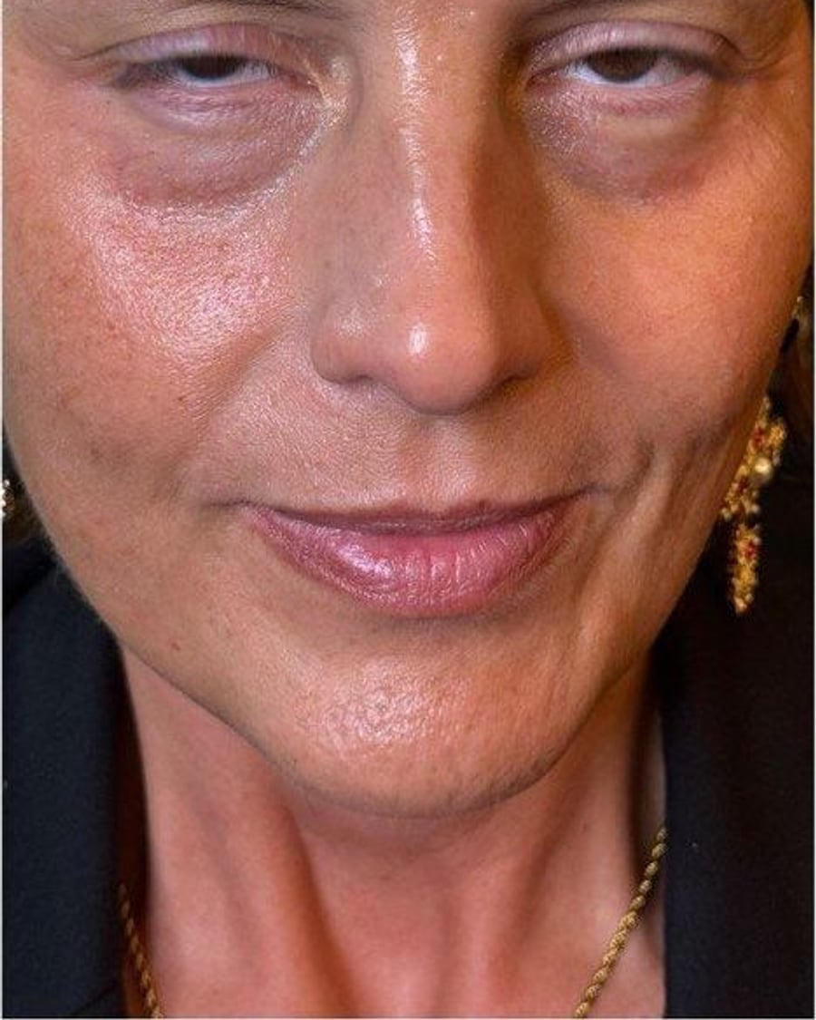 Soft glam, before